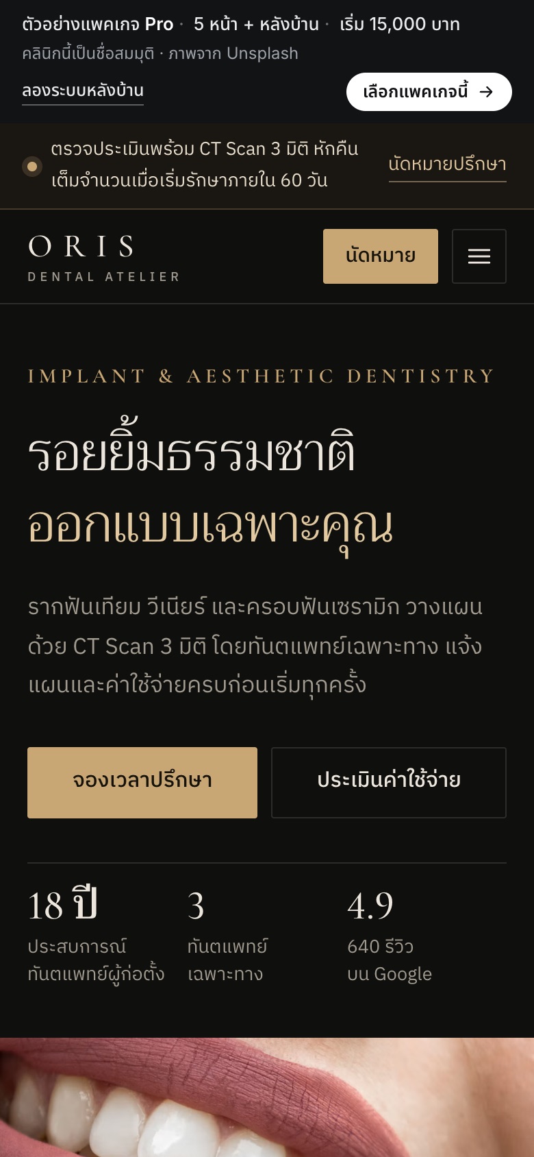 เว็บตัวอย่าง ORIS Dental Atelier · รากฟันเทียม บนมือถือ